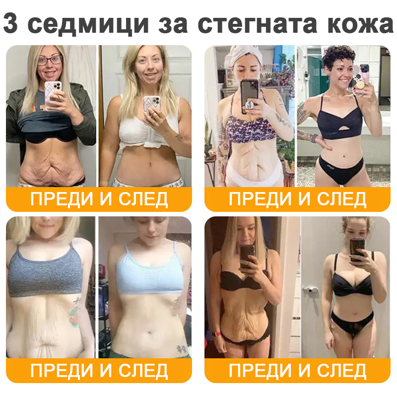 VLSVLS® Крем с пчелна отрова за регенерация на кожата (👨⚕️ подходящ за всички възрастови групи, препоръчан от AAD) 💎