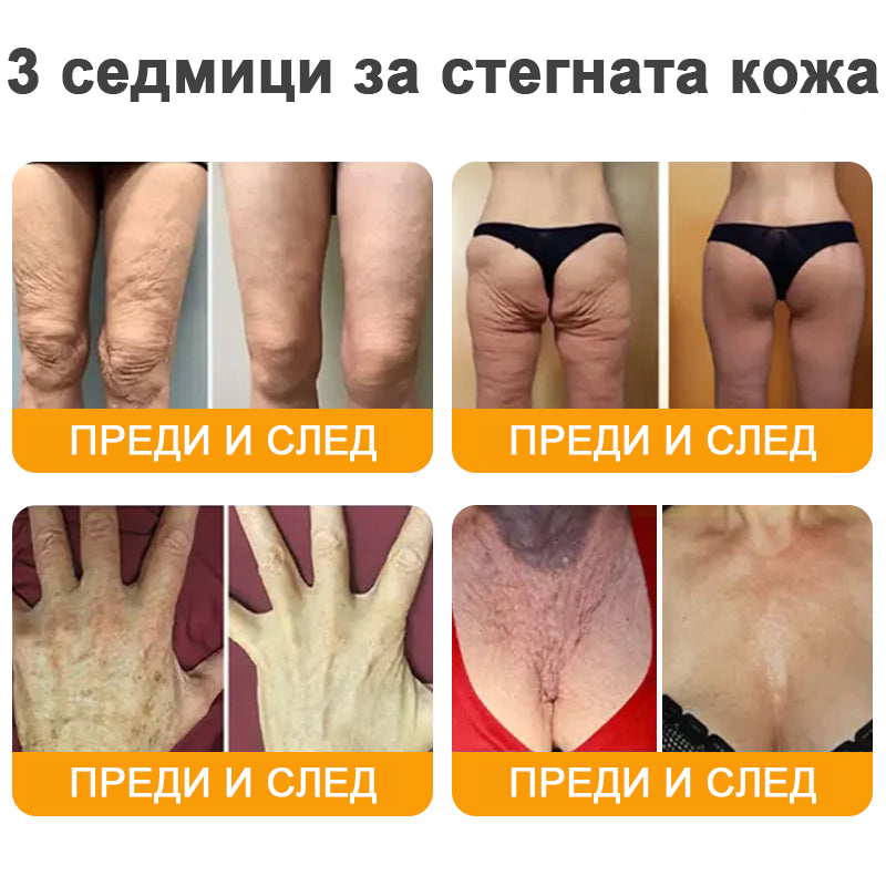 VLSVLS® Крем с пчелна отрова за регенерация на кожата (👨⚕️ подходящ за всички възрастови групи, препоръчан от AAD) 💎