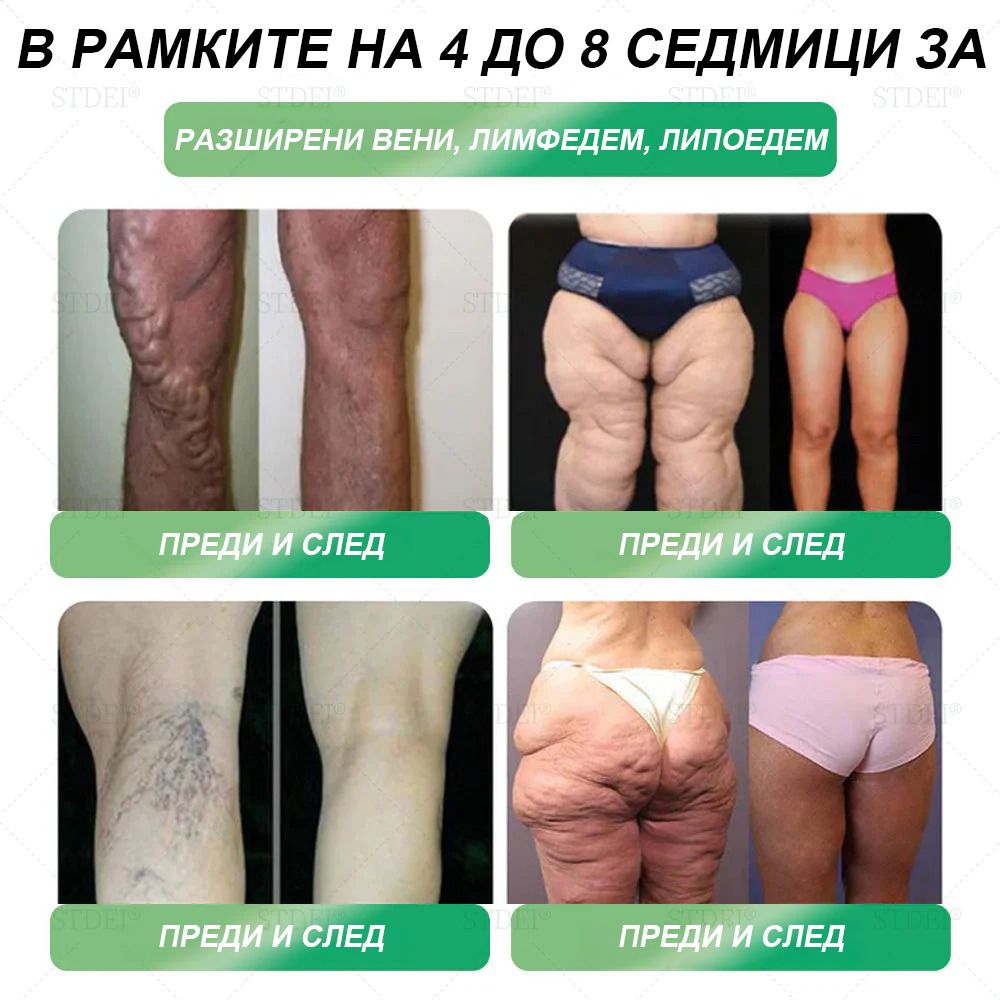 💎| Официален магазин | 𝑆𝑇𝐷𝐸𝐼® 𝐺𝐿𝑃-1 Отслабване Орален разтвор - 👨⚕️ Затлъстяване, сърдечно-съдови заболявания, диабет и други проблеми