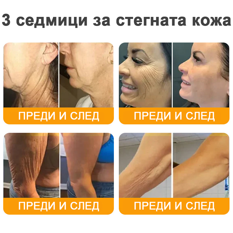 VLSVLS® Крем с пчелна отрова за регенерация на кожата (👨‍⚕️ подходящ за всички възрастови групи, препоръчан от AAD) 💎